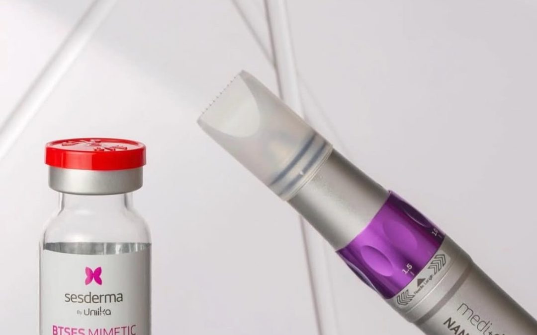 Peeling et Microponction à Agde : améliorer la qualité de la peau naturellement